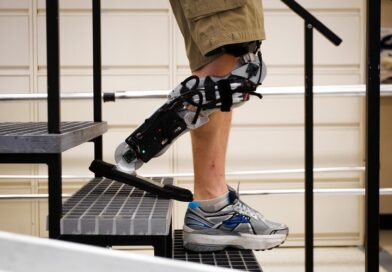 Revolución Médica: El futuro de las prótesis biónicas